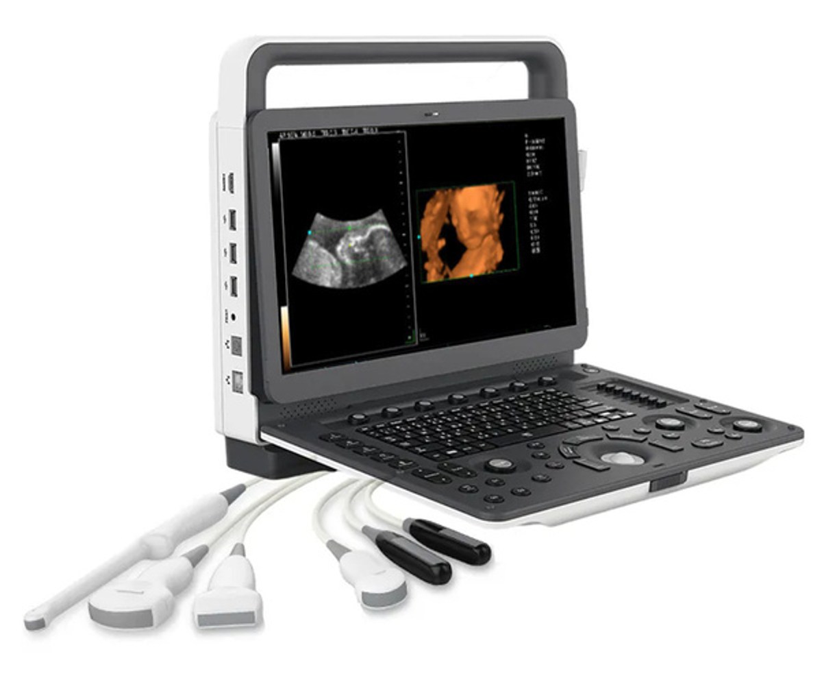 USG Portable 4D Color Doppler