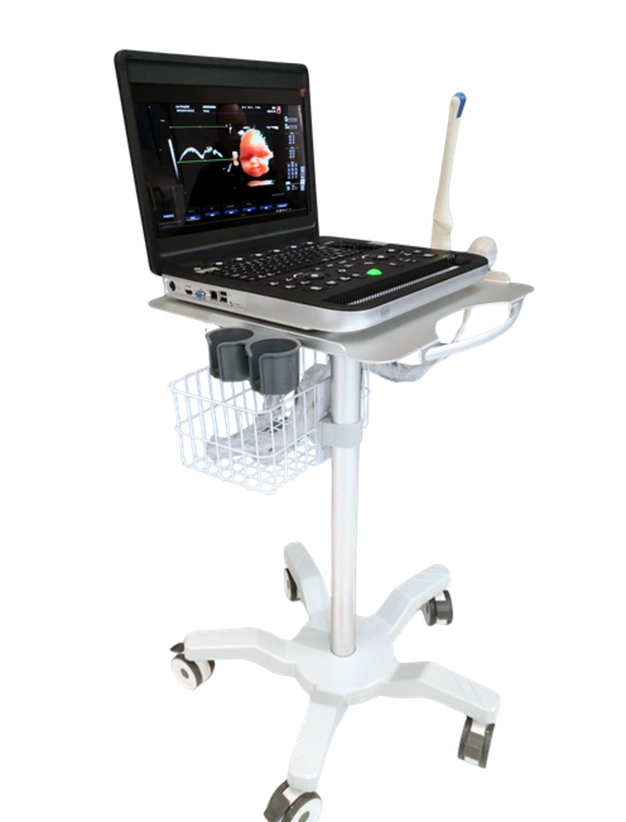 USG Laptop 4D Color Doppler